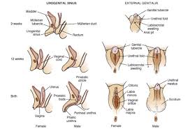 Differences in sex development Differences in sex development